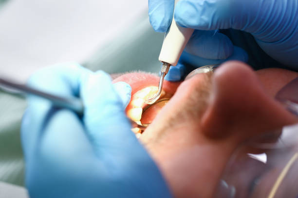 Best Knocked-Out Tooth Emergency  in Arrowhead Beach, NC