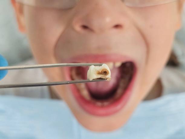 Best Dentist for Tooth Abscess  in Arrowhead Beach, NC