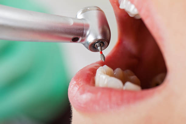Best Dentist for Tooth Abscess  in Arrowhead Beach, NC